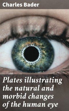 Plates illustrating the natural and morbid changes of the human eye (eBook, ePUB) - Bader, Charles