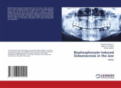 Bisphosphonate Induced Osteonecrosis in the Jaw - Kumar D., Prasanna;G. Palekar, Madhuri;Kulkarni, Sneha