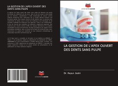 LA GESTION DE L'APEX OUVERT DES DENTS SANS PULPE - Joshi, Dr. Keyur