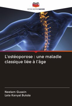 L'ostéoporose : une maladie classique liée à l'âge - Gusain, Neelam;Kanyal Butola, Lata