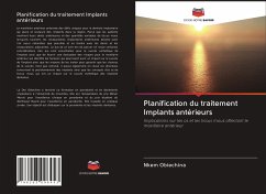 Planification du traitement Implants antérieurs - Obiechina, Nkem