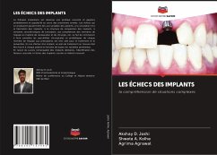 LES ÉCHECS DES IMPLANTS - Joshi, Akshay D.;Kolhe, Shweta A.;Agrawal, Agrima