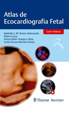 Cover Atlas de Ecocardiografia Fetal (eBook, ePUB)