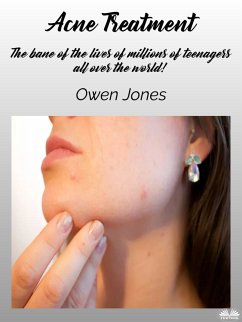 Acne Treatment (eBook, ePUB) - Jones, Owen