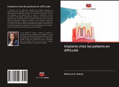 Implants chez les patients en difficulté - Avhad, Reshma B.