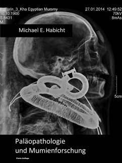 Handbuch Paleopathologie und Mumienforschung (eBook, ePUB)