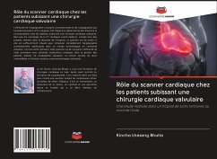 Rôle du scanner cardiaque chez les patients subissant une chirurgie cardiaque valvulaire - Bhutia, Kincho Lhasong
