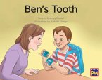 Ben's Tooth