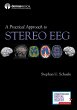 A Practical Approach to Stereo EEG - Bild 1
