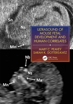 Ultrasound of Mouse Fetal Development and Human Correlates - Peavey, Mary C.; Dotters-Katz, Sarah K.