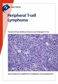 Fast Facts: Peripheral T-cell Lymphoma (eBook, ePUB)