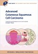 Fast Facts: Advanced Cutaneous Squamous... - Bild 1