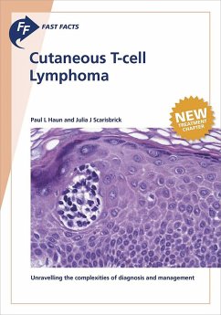 Cover Fast Facts: Cutaneous T-cell Lymphoma (eBook, ePUB)