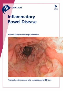 Fast Facts: Inflammatory Bowel Disease - Rampton, David S;Shanahan, Fergus