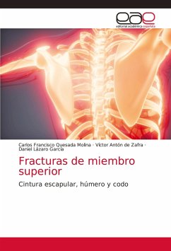 Fracturas de miembro superior