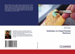 Esthetics in Fixed Partial Denture - Borse, Siddhesh;Chaware, Sachin