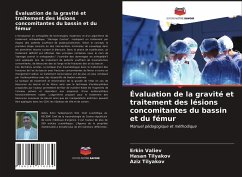 Évaluation de la gravité et traitement des lésions concomitantes du bassin et du fémur - Valiev, Erkin;Tilyakov, Hasan;Tilyakov, Aziz