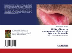 Utility of Laser in management of Recurrent Aphthous Stomatitis - Dangore-Khasbage, Suwarna