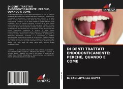 DI DENTI TRATTATI ENDODONTICAMENTE: PERCHÉ, QUANDO E COME - LAL GUPTA, Dr KANHAIYA