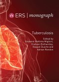 Tuberculosis (eBook, ePUB)