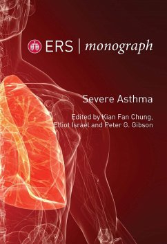 Cover Severe Asthma (eBook, ePUB)