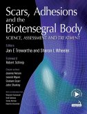 Scars, Adhesions and the Biotensegral Body (eBook, ePUB) Scars, Adhesions and the Biotensegral Body (eBook, ePUB)