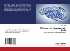 MRI guide of Hydrocephalic Brain
