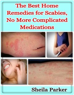 Cover The Best Home Remedies for Scabies, No More Complicated Medications (eBook, ePUB)