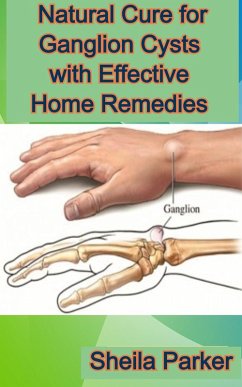 Cover Natural Cure for Ganglion Cysts with Effective Home Remedies (eBook, ePUB)