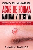 Cómo Eliminar el Acné de Forma Natural y Efectiva: Remedios altamente efectivos para eliminar granos, espinillas, puntos negros y cicatrices para siempre (eBook, ePUB)