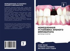 NEMEDLENNAYa USTANOVKA ZUBNOGO IMPLANTATA - MANI, AMIT;SACHDEVA, SHIVANI;SODHI, JASLEEN KAUR