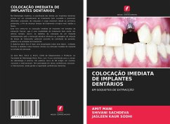 COLOCAÇÃO IMEDIATA DE IMPLANTES DENTÁRIOS - MANI, AMIT;SACHDEVA, SHIVANI;SODHI, JASLEEN KAUR