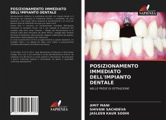 POSIZIONAMENTO IMMEDIATO DELL'IMPIANTO DENTALE - MANI, AMIT;SACHDEVA, SHIVANI;SODHI, JASLEEN KAUR