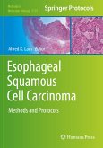 Esophageal Squamous Cell Carcinoma