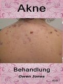 Akne-Behandlung (eBook, ePUB)