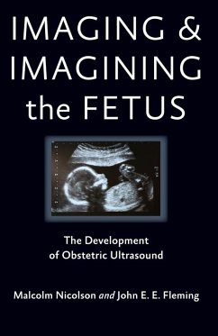 Imaging and Imagining the Fetus (eBook, ePUB) - Nicolson, Malcolm