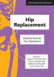 Hip Replacement (eBook, ePUB) - Bild 1