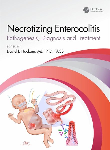 Necrotizing Enterocolitis (eBook, ePUB) Necrotizing Enterocolitis (eBook, ePUB)