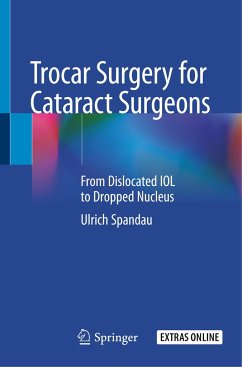 Trocar Surgery for Cataract Surgeons - Spandau, Ulrich