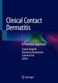 Clinical Contact Dermatitis (eBook, PDF)