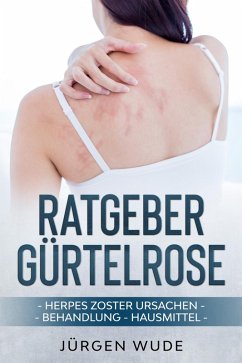 Ratgeber Gürtelrose (eBook, ePUB) - Wude, Jürgen