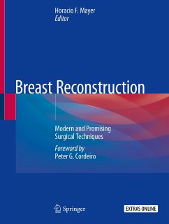 Breast Reconstruction