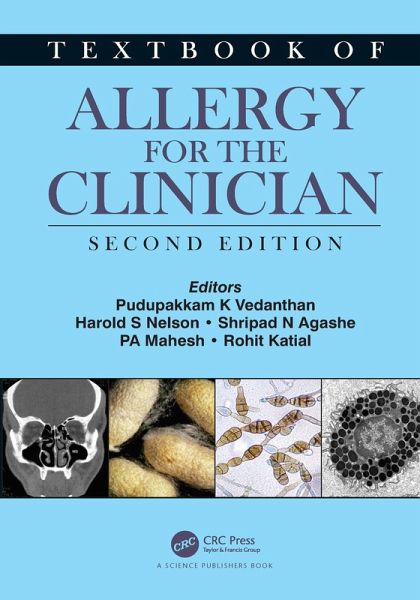 Textbook of Allergy for the Clinician (eBook, PDF)