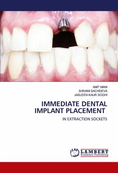 IMMEDIATE DENTAL IMPLANT PLACEMENT