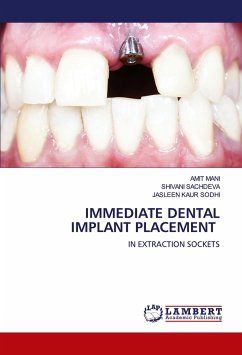 IMMEDIATE DENTAL IMPLANT PLACEMENT - MANI, AMIT;SACHDEVA, SHIVANI;SODHI, JASLEEN KAUR