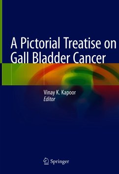 A Pictorial Treatise on Gall Bladder Cancer (eBook, PDF)