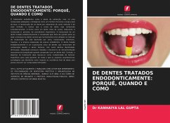 DE DENTES TRATADOS ENDODONTICAMENTE: PORQUÊ, QUANDO E COMO - LAL GUPTA, Dr KANHAIYA