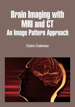 Cover Brain Imaging with MRI and CT (eBook, ePUB)