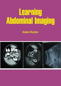Learning Abdominal Imaging (eBook, ePUB) - Hunter, Adam
