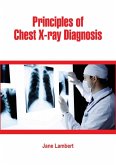 Principles of Chest X-ray Diagnosis (eBook, ePUB)